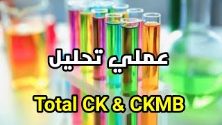 عملي تحليل total CK & CKMB