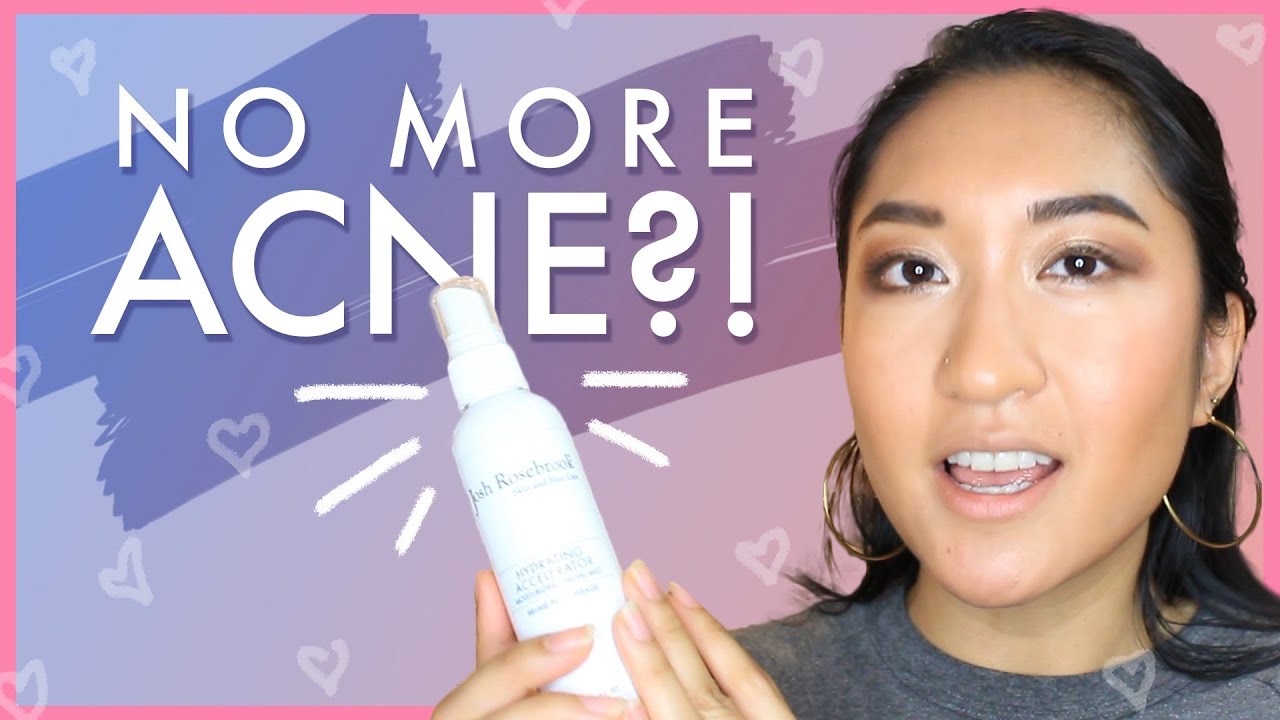 My Top 5 Cruelty Free Skincare Products For Acne AllNatural Skincare