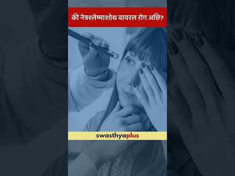 की नेत्रश्लेष्माशोथ वायरल रोग अछि? | Is Conjunctivitis a Viral Infection? | Dr Deepak Kumar Jha