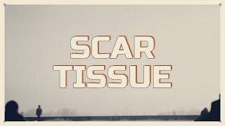 Scar Tissue (Lyrics) | Maxed Card, Rented Car, Empty Fridge – Then a Bailiff Letter Changed