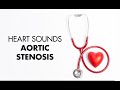 Aortic stenosis  heart sounds  medzcool
