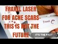 How to treat acne scars- NOT with Fraxel Laser