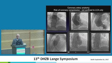 Qureshi: "Current resuls - Venus P valve"