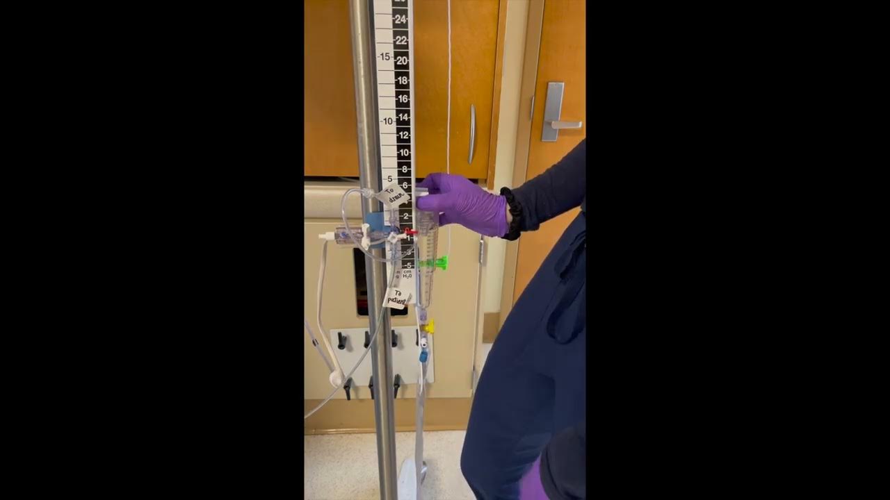 Lumbar Drain Explanation YouTube