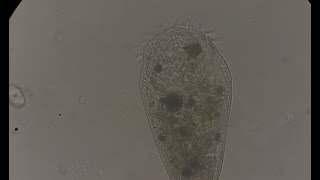 Stentor roeselii, Free - swimming conformation (Full video)