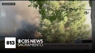 2 people suffer burns in duplex fire