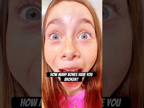 How many BONES have you BROKEN?!😮