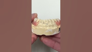 Titanium partials with pink clasps!