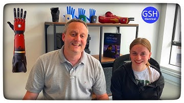 Open Bionics - Hero Arm 🦾 - Casting for Vienna’s Prosthetic