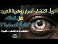 Finally Uncover the Secrets of the Zohariya Eye 7 Signs You Possess the Gaze of Power and  mp3