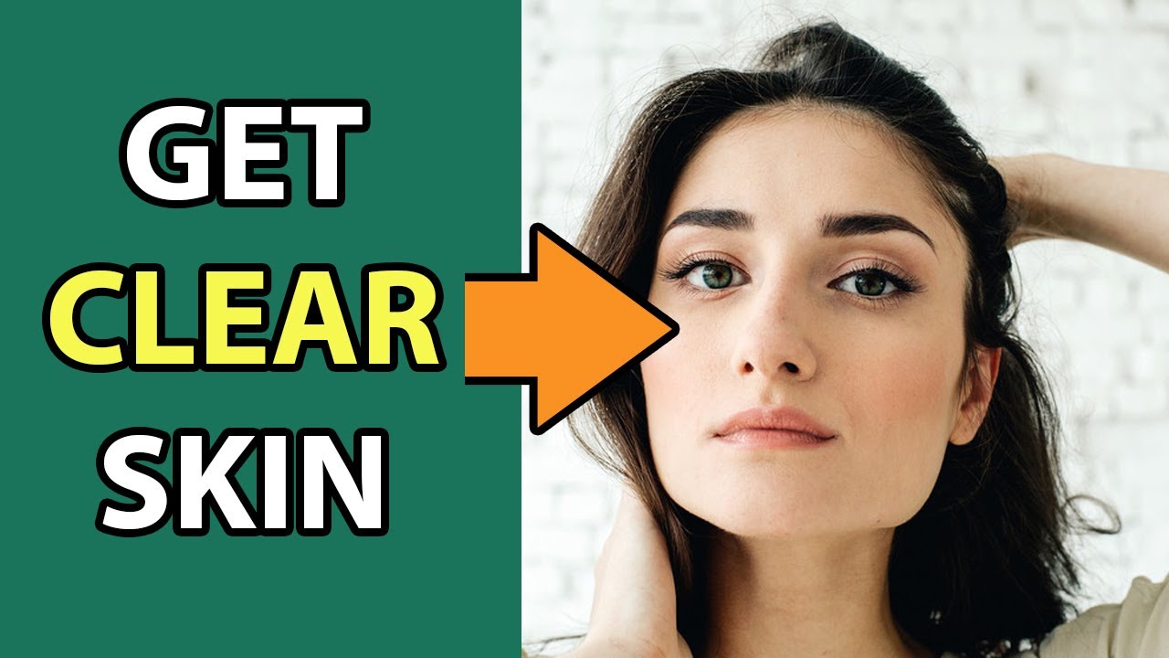 How to Get Rid of Acne? - 5 Tips for a Clear Skin - YouTube