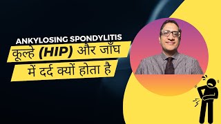 Ankylosing spondylitis से कूल्हे (hip) और जाँघ में दर्द क्यों होता है?