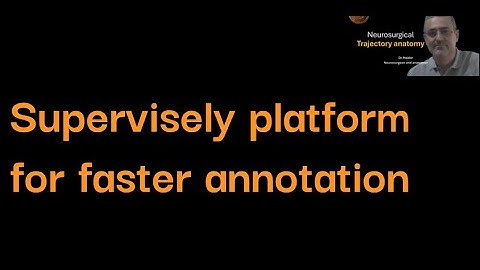 Supervisely for faster annotation.