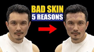 5 MISTAKES YOU DO TO HAVE WORST SKIN QUALITY |NATURAL SOLUTIONS|