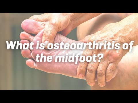 Video: Kas ir tarsometatarsālais osteoartrīts?