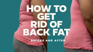 How To Get Rid Of Back Fat