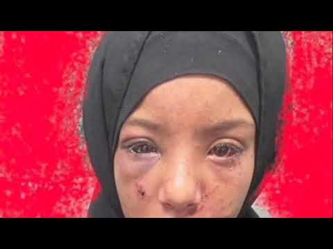 حاول خلع عينيها لعدم التعرف عليه محاوله هتك عرض طفله تهز الشرقيه