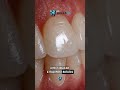 Dentists - comment “molar” for access to custom reels / carousels posted daily for you.