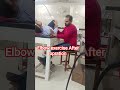 elbow exercise after operation Dr mangal PT physiotherepy clinic mansa punjab