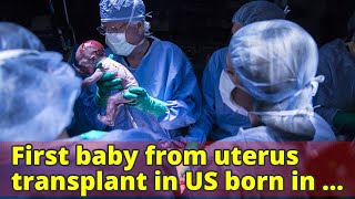 First baby from uterus transplant in US born in Dallas