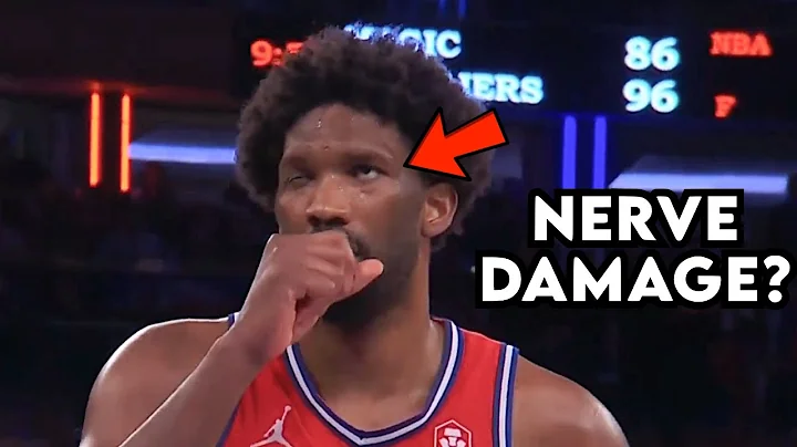 Joel Embiid Can’t Blink His Eye - Doctor Reacts - DayDayNews