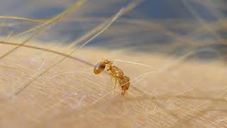 Electric ant | Wikipedia audio article