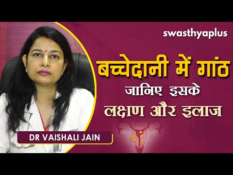 ओवेरियन सिस्ट (अंडाशय में गांठ) - जानें कारण और लक्षण | Dr Vaishali Jain on Ovarian Cyst in Hindi