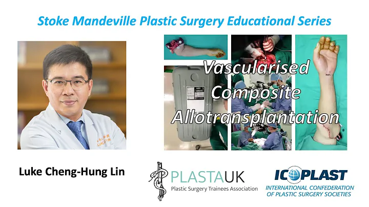 Luke Cheng-Hung Lin: Vascularised Composite Allotransplantation - DayDayNews