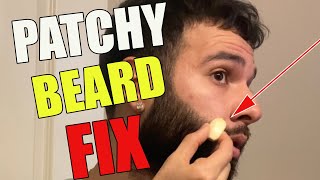 Celebrity The SECRET to Curing a Patchy Beard! *The Untold Remedy* Profile