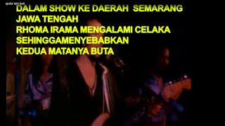 Rhoma Irama celaka saat nyanyi (Lain kepala lain hati)
