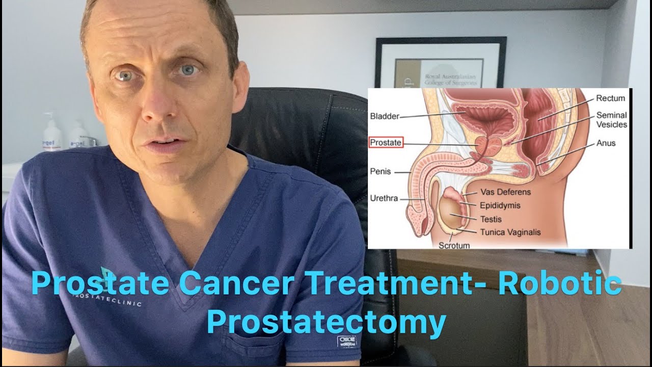 Prostate Cancer Treatments Robotic Prostatectomy Youtube