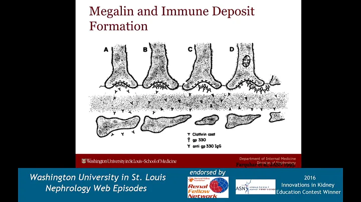 Web Episode #024 - The Story of the Membranous Antigen