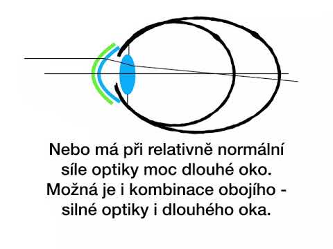 Video: Asteroid Koji Je Lebdio U Zraku Prestrašio Je Amerikance - Alternativni Pogled