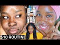 I Cleared Acne & Hyperpigmentation with Affordable Skincare (2026 Results)