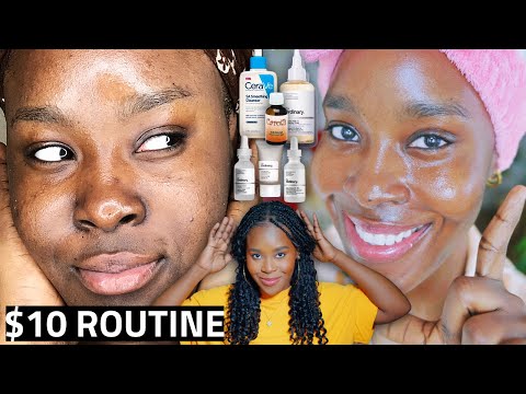 I Cleared Acne & Hyperpigmentation with Affordable Skincare (2026 Results)