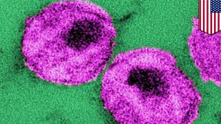 HIV cure? New molecule can 'kick and kill' dormant HIV cells hiding in the body - TomoNews