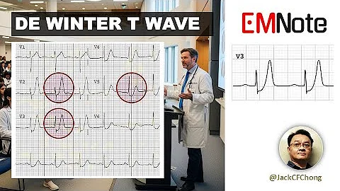 De Winter T Waves (STEMI Equivalent)