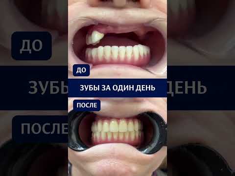 Кейс пациента