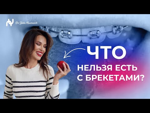 ЧТО НЕЛЬЗЯ ЕСТЬ С БРЕКЕТАМИ? ПОЛЕЗНЫЕ СОВЕТЫ, ЛАЙФХАКИ