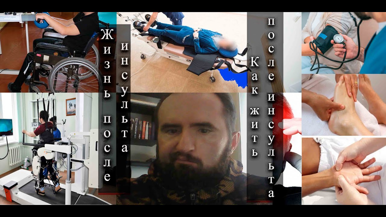Когда Можно Заниматься Сексом После Инсульта