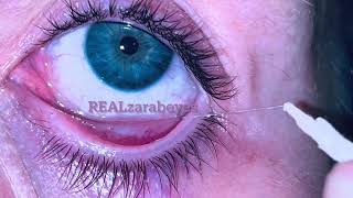 Removing eye make up/eye mucous fishing syndrome. WHITE CLAY MASK