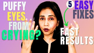 How to Fix Puffy Eyes After Crying | 5 TIPS