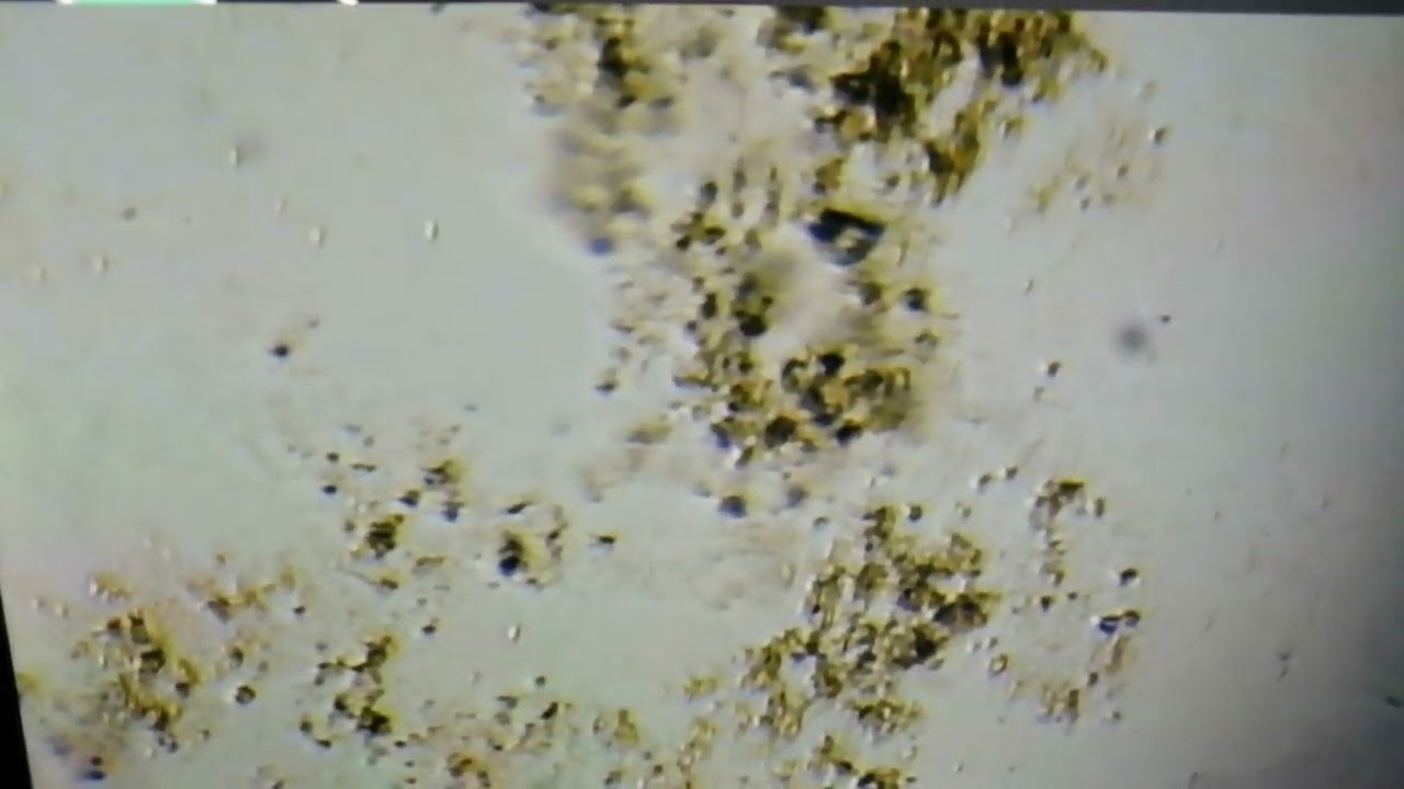 قطرة ماء تحت المجهر فيها يظهر البرامسيوم 