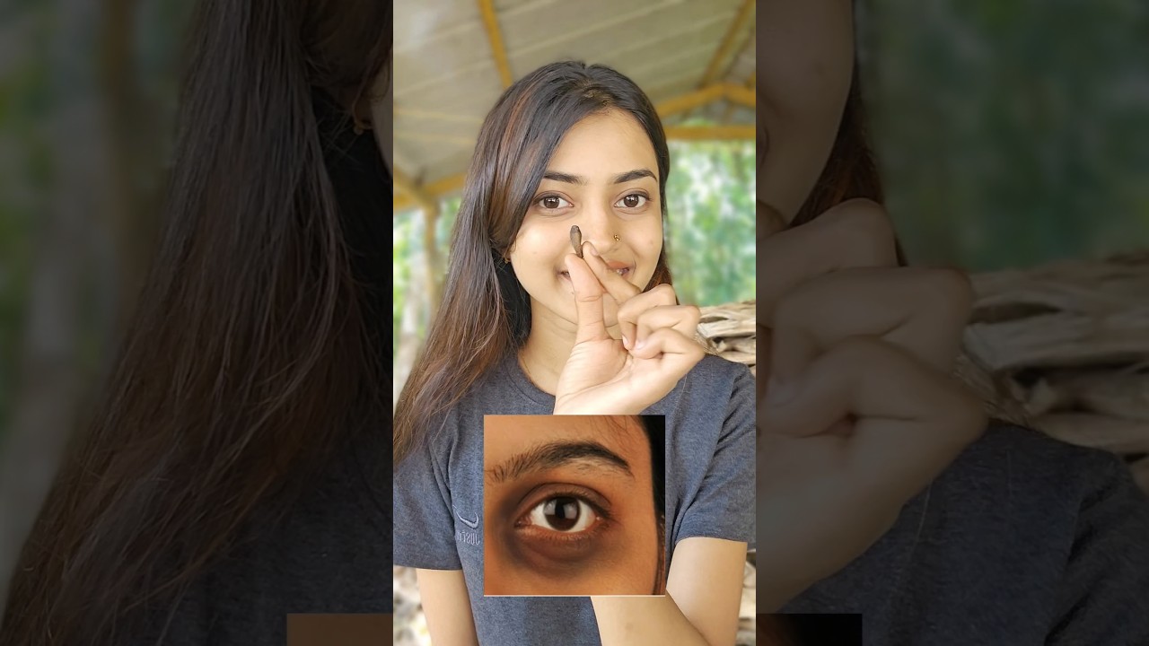 Вы можете полностью убрать темноту вокруг глаз😳 