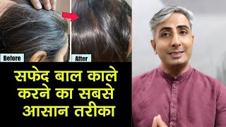 बाल काले करने का नेचुरल तरीका | Natural Home Remedies to Get Black Hairs I Dr. Manoj Das