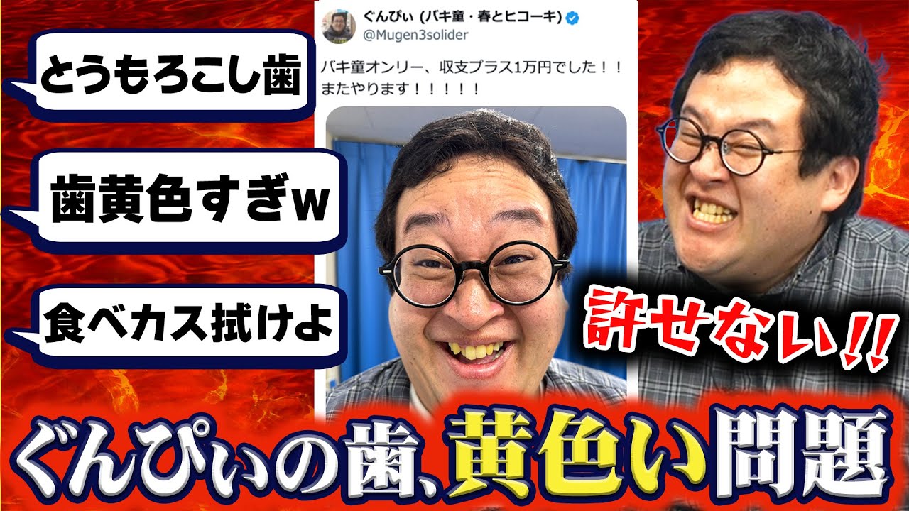 【不潔】ぐんぴぃの歯が黄色すぎてSNSで何も伝わらなかった件【歯医者】