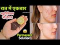     pigmentation     100   how to remove pigmentation