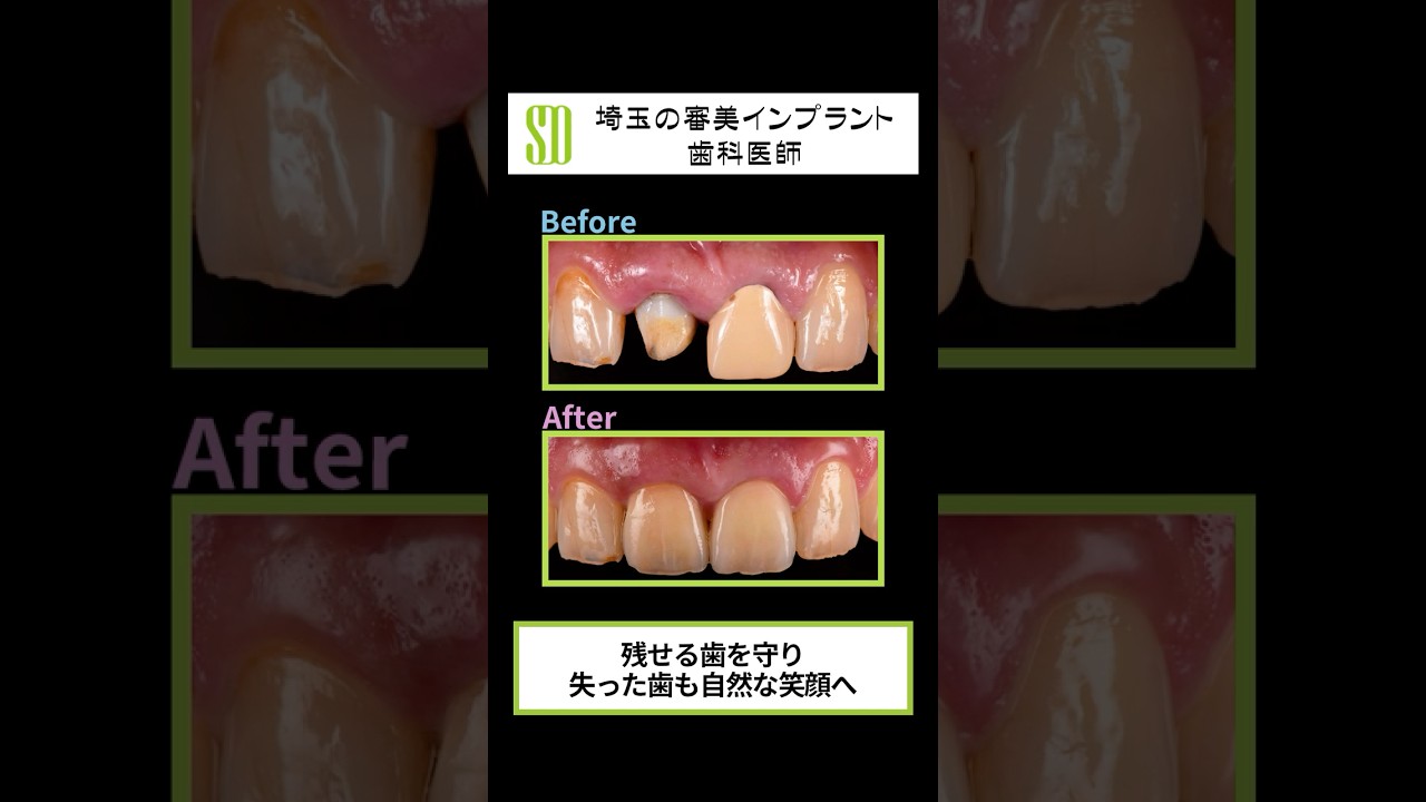 関口デンタルオフィス（審美インプラント治療サイト）