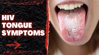 HIV Tongue Symptoms