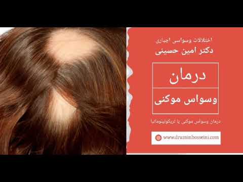 درمان اختلال وسواس موکنی یا تریکوتیلومانیا دکتر امین حسینی